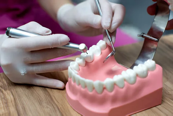Porcelain Crowns