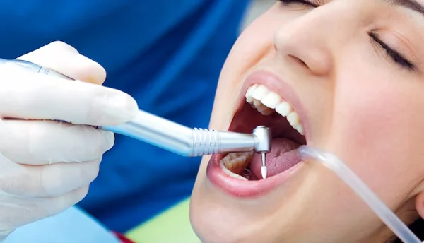 Dental Crowns And Fillings